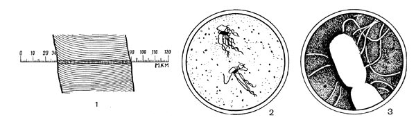 Рис. 1. Сравнительная величина волоса и бактерий: 1 — увеличенное   изображение   волоса (X 500);   2 — бактерии в поле зрения  светового  микроскопа (X 2000);   з — бактерии   под электронным микроскопом (X 20 000).