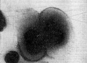 Рис. 7. Капсула клеток Azotobacter chroococcum. Увел. X 25 000.