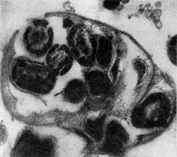 Рис. 25. Клетка бактерии-хозяина (Tuberoidobacter sp.), заполненная размножившимися паразитами. Электронная микрофотография. Увел, х 40000.