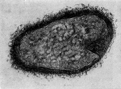 Рис. 26. Цисты (форма покоя) паразитических бактерий Bdellovibrio. Увел. X 50000.
