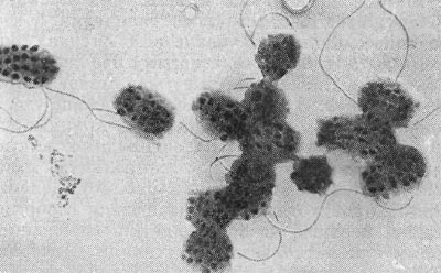 Рис. 28. Почвенная бактерпя со сферическими выступами на поверхности клетки (Agrobacterium polyspheroidum). Увел. X 15000.