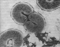 Рис. 32. Тороидальные клетки Microcyclus flavus. Электронная микрофотография. Увел. X 25000.