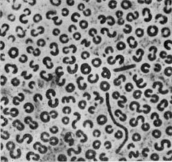 Рис. 33. Тороидальные клетки Spirosoma sp. Фазовоконтрастный микроскоп. Увел. XI600.