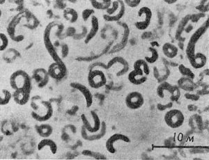 Рис. 41. Вегетативные клеткп в виде вибрионов, торондов и спирилл у Desulfotomaculum sp. (сульфатредуцпрующая бактерия). Увел. X 2100.