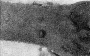 Рис. 44. Ультраструктура   клеточной   стенки   у   Clostridium sp.   Увел. X 45 000.