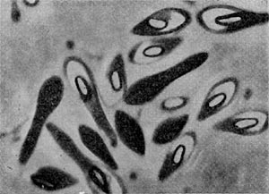 Рис. 48. Клостридиальная форма клеток. Споры снабжены светлыми конусовидными колпачками. Clostridium species, шт. 1. Увел. X 3500.