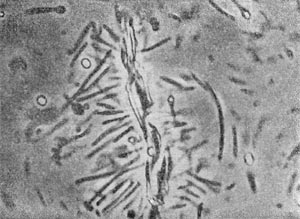 Рис. 51. Плектридтти, адсорбированные на целлюлозном волокне. (Клетчаткоразрушающне бактерии.) Увел. X 3500.