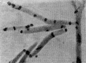 Рис. 53. Слияние нуклеоидов на полюсах клеток (перед спорообразованием).   Clostridium   sporopenitum. Увел. X 3500.