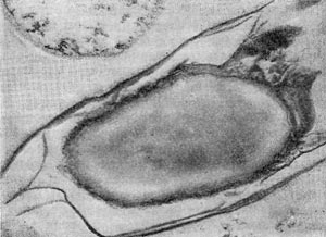 Рис. 57. Зрелая спора Clostridium penicillum. Сердцевина выглядит бесструктурной. Видны многослойный экзоспорпум п выросты на оболочке споры. Увел. X 45 000.