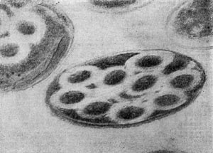 Рис. 61. Поперечный ультратонкнй срез клеток С1. penicillum. Хорошо заметен лизис цитоплазмы вокруг трубчатых выростов (светлые зоны). Увел. X 96 000.