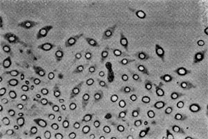 Рис. 64. Сульфатредуцирующая спороносная бактерия. Клетки при спорообразовании раздуваются. Увел. Х2700.