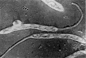 Рис. 71. Типичные клетки бактерий рода Caulobacter. Электронная микрофотография. Увел. X 20 000.