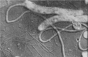 Рис. 73. Клетки стебельковой бактерии пз рода Asticcacaulis.  Электронная микрофотография. Увел. X 20 000.