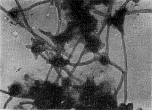 Рис. 79. Скопление клеток из рода Ancalomicrobium Суспензия почвы в электронном микроскопе. Увел. X 15 000. 