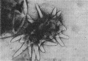 Рис.  82. Клетка неизвестного микроорганизма,  напоминающего Prosthecomicrobium. Увел. X 25 000.