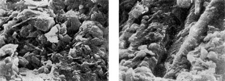 Рис. 120. Микроструктура микробных очагов (фото   в   сканирующем электронном   микроскопе).   Увел. X 1600.