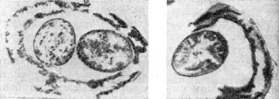 Рис. 145. Образование (слева) и выход (справа) артросиор из клеток клубеньковых бактерий клевера. Ультратонкие срезы. Увел. X 30 000.