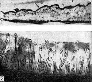 Рис. 147. Слой гранулированного вещества на поверхности корневого волоска (1) при электронно-микроскопическом исследовании (по П. Дарту, Ф. Мерсеру, увел. X 30 000) и слизистый зооглейный слой (2), в который погружены корневые волоски клевера, под световым микроскопом (увел. X 80).
