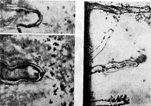 Рис. 148. Скопления клубеньковых бактерий вокруг корневых волосков. Стрелкой показано движение клеток клубеньковых бактерий к вершине корневого волоска клевера.