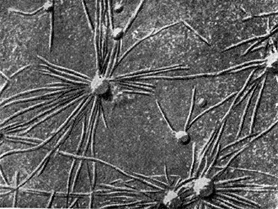 Рис. 149. Клетки клубеньковых бактерий на поверхности инфицированного корневого волоска бобового растения (по П. Дарту, Ф. Мерсеру).