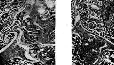 Рис. 154. Интерцеллюлярные инфекционные нити в виде кармана (справа) и факела (слева) с клубеньковыми бактериями. Стрелкой показана клетка бактерий, приготовившаяся к выходу в цитоплазму растительной клетки. Увел. X 20 000.