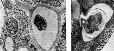 Рис. 156. Клетки  клубеньковых  бактерий в межклеточном пространстве (слева,    по Д. Джордану) и  в момент входа  из  межклеточного  пространства в клетку  растения (справа). Увел. X 60 000.