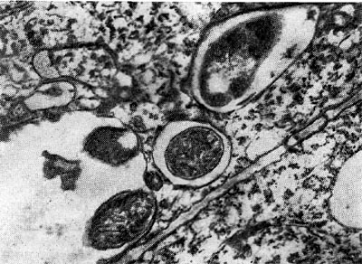 Рис. 157. Выход клубеньковых бактерий в ткань корня из везикулоподобных образований инфекционных нитей (по Гудчильду и Бергерсену).