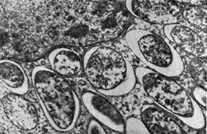 Рис. 160. Клетки клубеньковых бактерий вокруг ядра растительной клетки клубеньков вики. Увел. X 20 000.