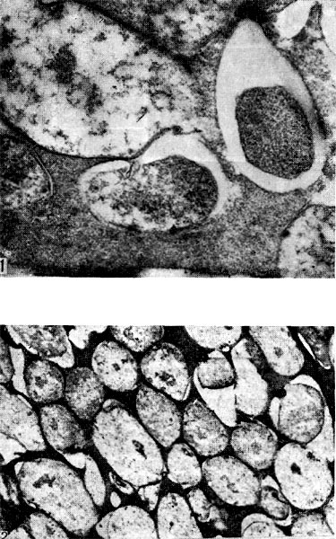 Рис. 161. Переход бактерий в бактероиды (1 — увел. Х25 000) и сформировавшаяся бактероидная ткань (2 — увел. X15 000) в клубеньках люцерны.