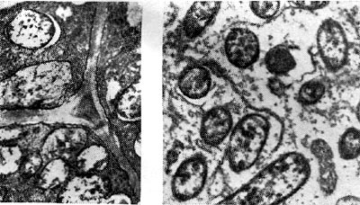 Рис. 162. Бактеропдная ткань в период активного функционирования клубеньков клевера (слева увел. X 10 000) и вики посевной (справа — увел. X 6000).