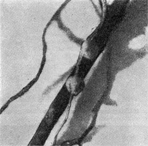 Рис. 170. Клубеньки на корнях вейштка лесного (по И.Л. Клевенской).