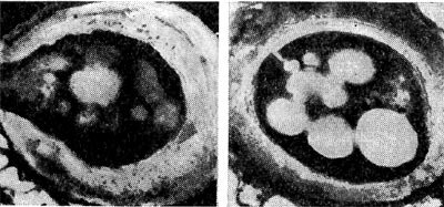 Рис. 175. Цисты азотобактера (по И. Чану и др.). Зрелая циста, наполненная гранулами жира и окруженная толстой плотной оболочкой (справа), и прорастающая циста (растущая молодая клетка разрывает оболочку цисты — слева). Увел. X 35 000.