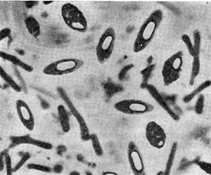 Рис. 178. Клетки Clostridium pasteurianum со спорами. Увел. X 3500 (по  В.И. Дуде).