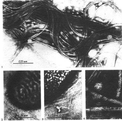 Таблица 43. Жгутики (1) и нитевидные выросты — фимбрии (2—4) у клеток клубеньковых бактерий люпина. Стрелками показаны места выхода фимбрии из клетки (по Майеру).