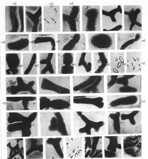 Таблица 44. Палочковидные бактерии (по) и бактероиды из клубеньков чины, вики, акации (увел, х 6000—10 000).